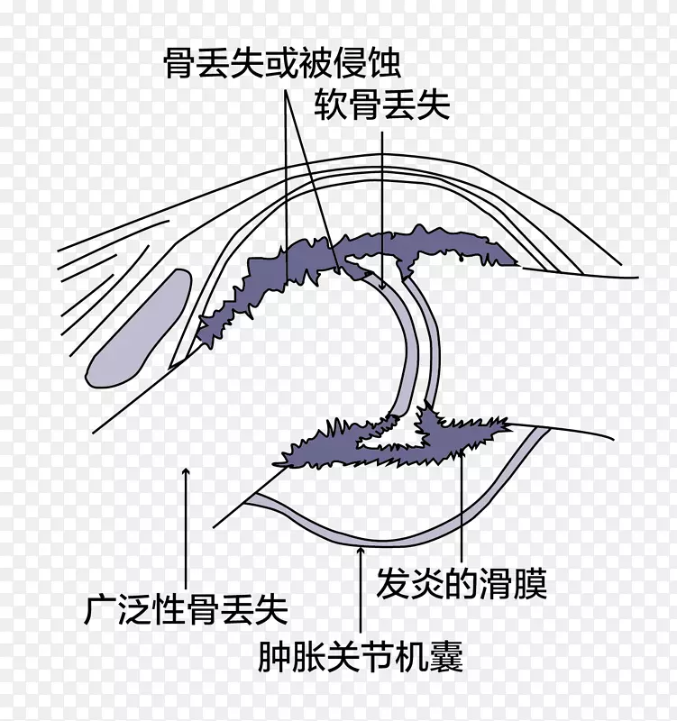 人体骨关节效果图