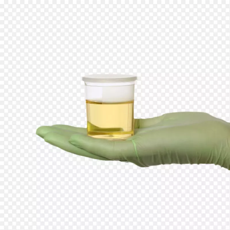戴着半透明绿色手套捧着一瓶尿液