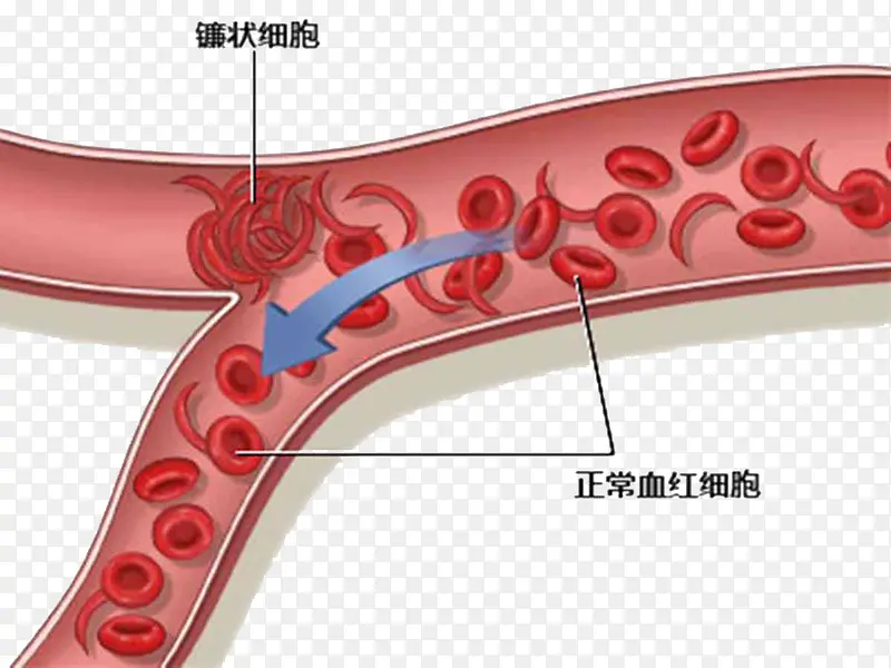 血红细胞示意图