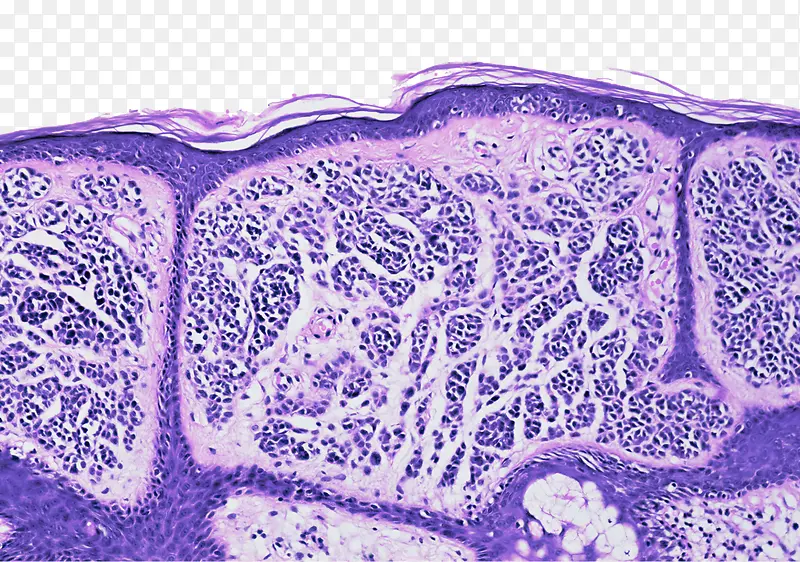 显微镜下的皮肤组织