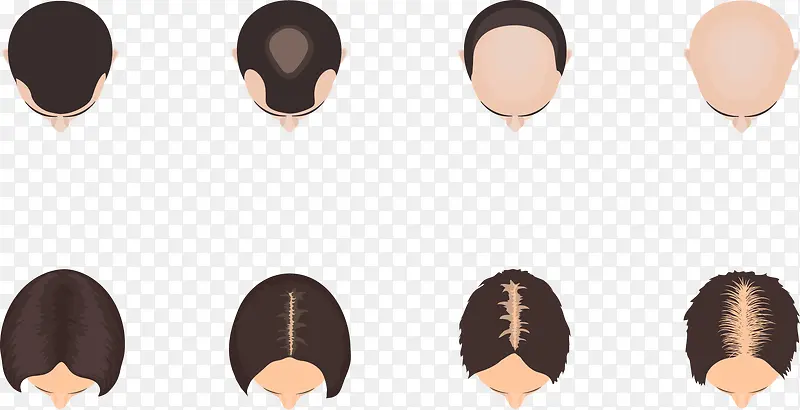 男性女性头顶发量图
