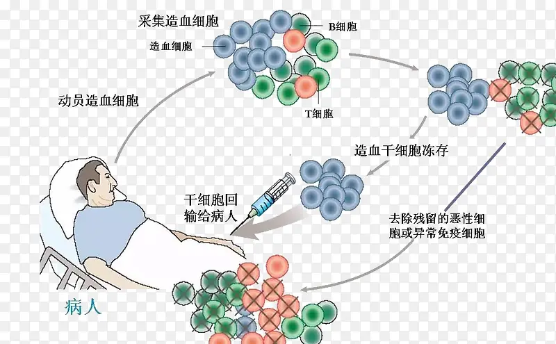 干细胞移植技术