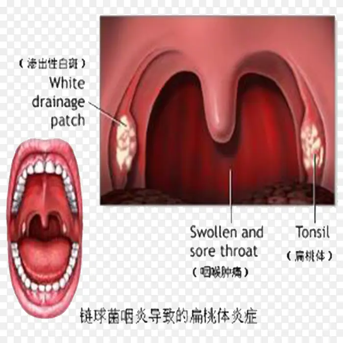 手绘喉咙细节图