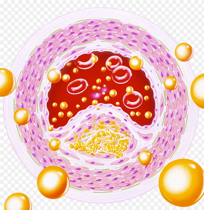 血脂细胞