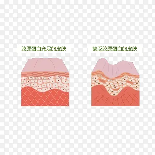 胶原蛋白皮肤