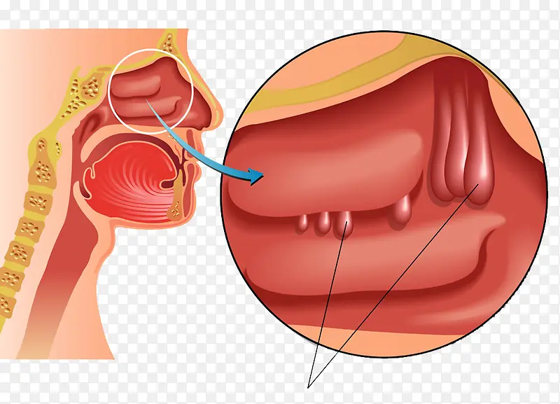 口腔肌肉描绘