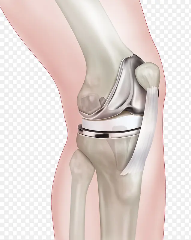 膝盖骨头结构