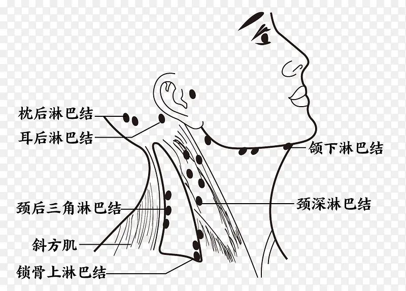 颈部淋巴 穴位图 穴位 颈部